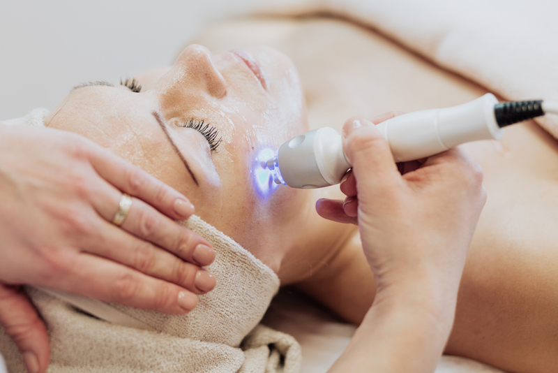 laser-huid laser-huid